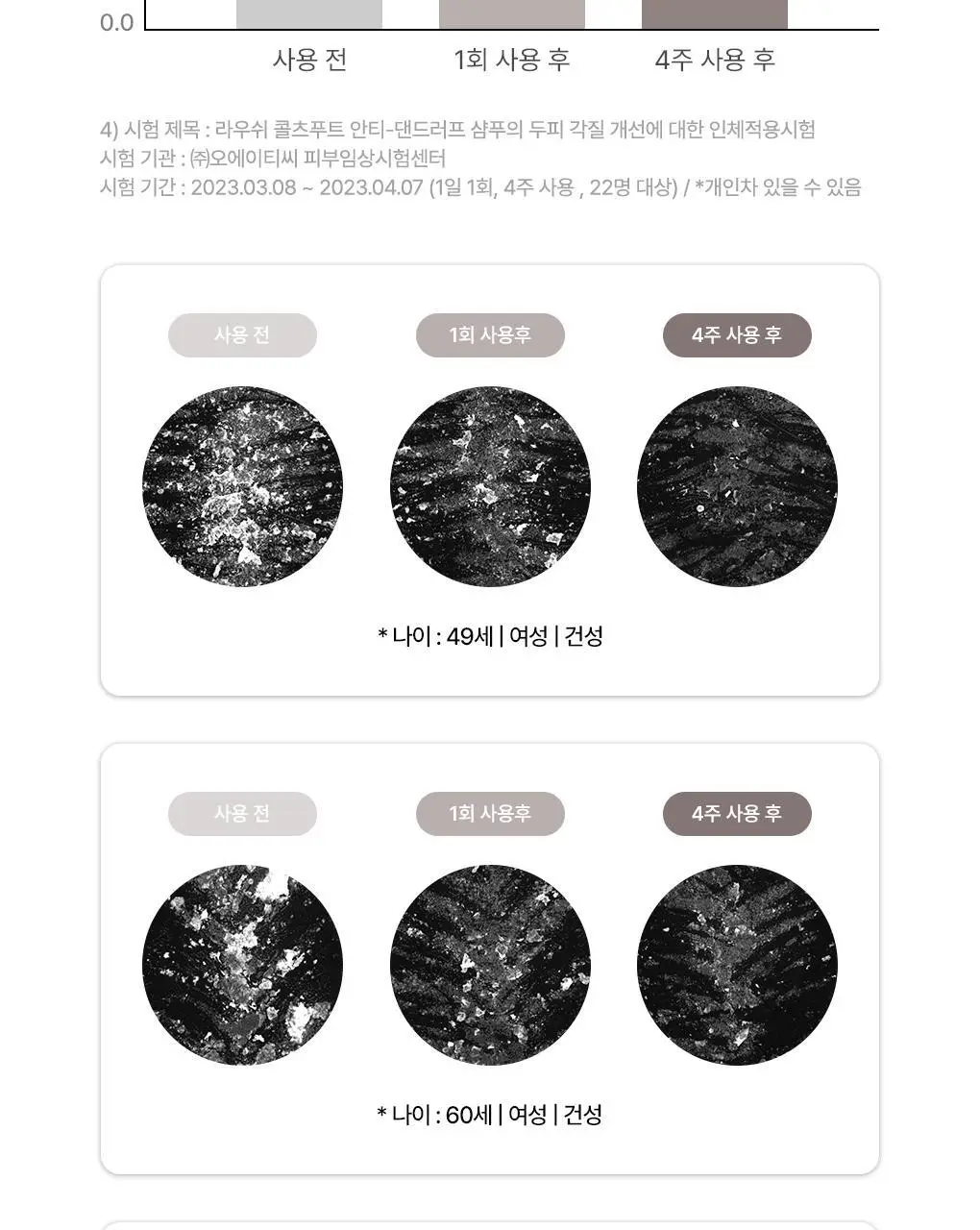 [두피뿌리&비듬관리set]라우쉬 윌로우바크 트리트먼트 샴푸 200ml&콜츠푸트 안티-댄드러프 샴푸 200ml 2종 기획 상세페이지 39
